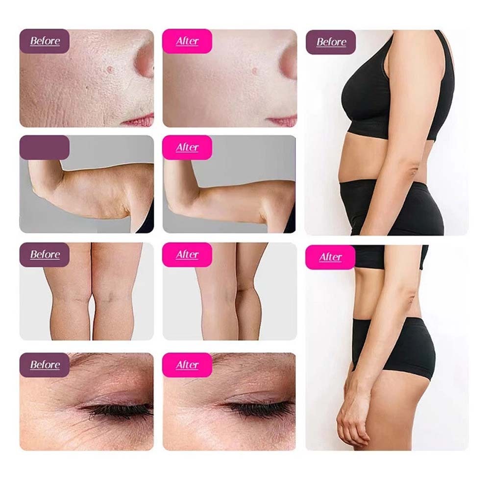 9in1 Ultrasonic Cavitation Machine Home Facial & Body Care Device Body Machine