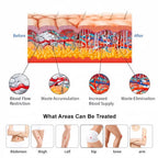 Electric Shockwave Therapy Machine ED Treatment Pain Relief Chiropractic Machine